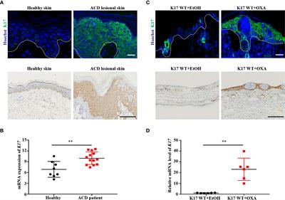 Keratin 17 Promotes T Cell Response in Allergic Contact Dermatitis by Upregulating C–C Motif Chemokine Ligand 20